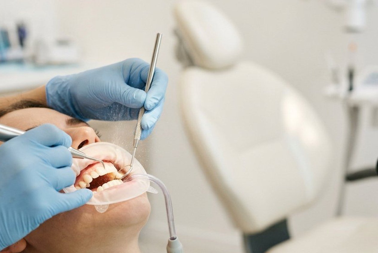Gum Treatment at The Dental Point