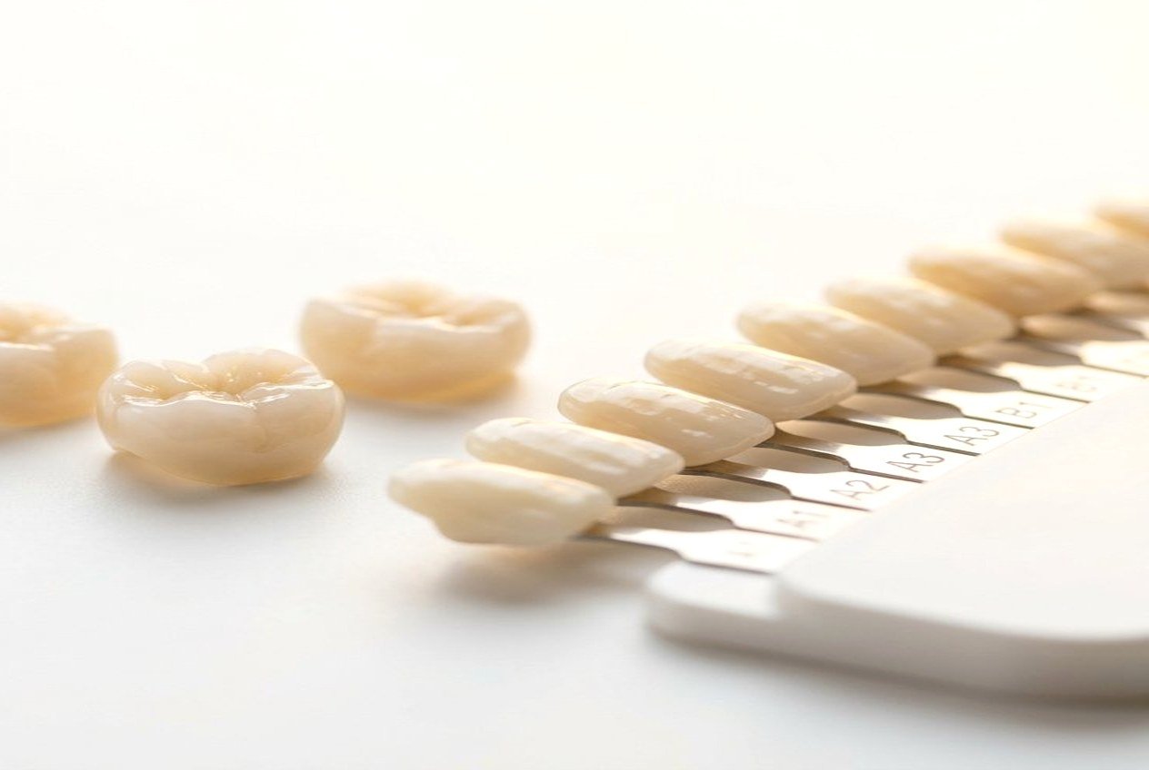 Teeth Whitening at The Dental Point